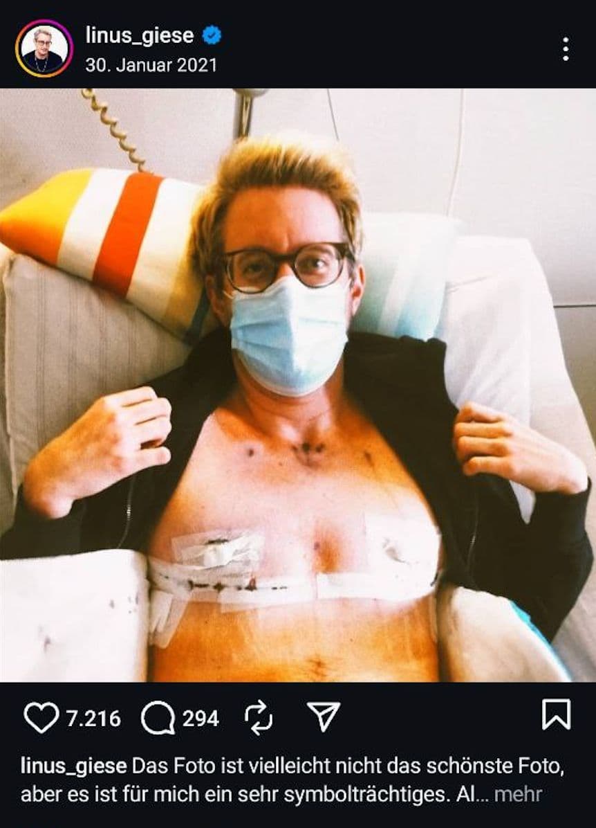 Giese teilte auf Instagram ein Foto von sich nach der Brustentfernungs-OP. Screenshot: Instagram / linus_giese.